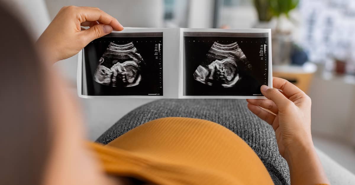 Pregnant woman looking at sonogram of baby with birth defect | The Haynes Firm